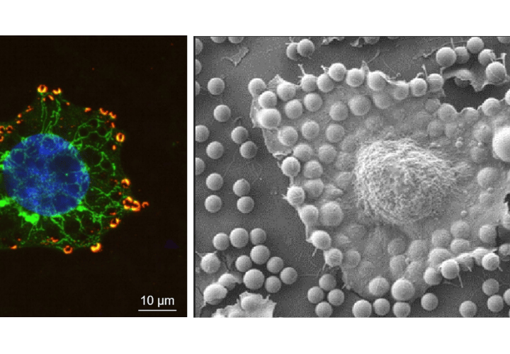 A New “Mechanical Sensor” Surface for Identifying Aggressive Cancer