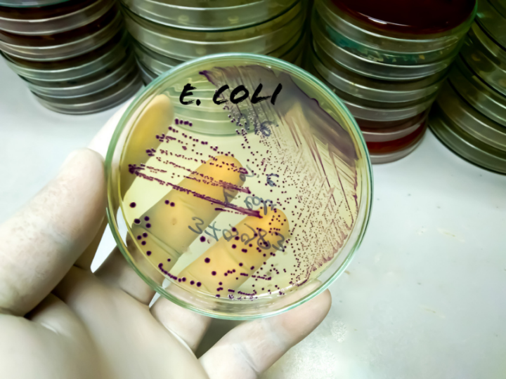 Disease-Causing E. coli Quickly Finds a New Way to Grip Human Cells—Revealing a Possible Target for Future Treatments